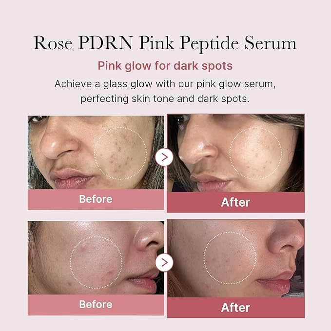 medicube Viral Serum Duo for Clear and Plump Skin: Kojic Acid Turmeric and PDRN Rose Pink Serum for Radiant Glow and Uneven Skin Tone & Texture Care | Giftable Skincare Set