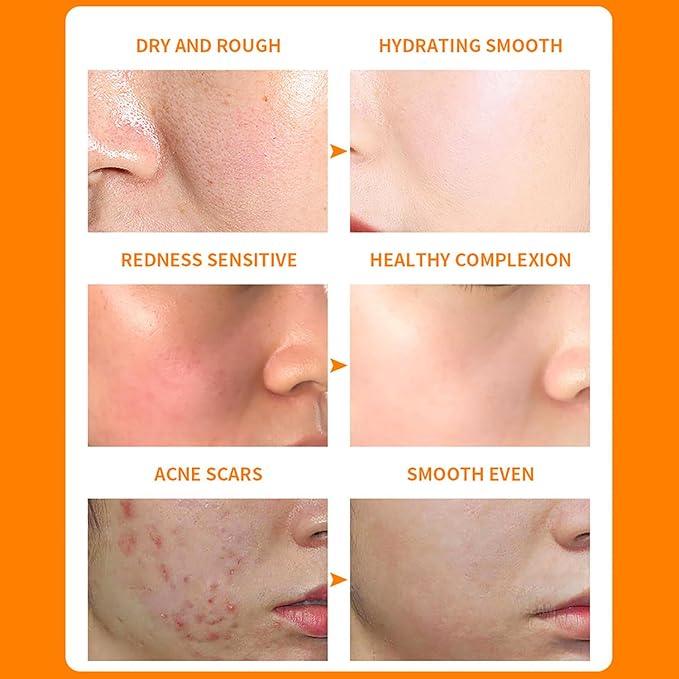 DISAAR Beauty Vitamin C Collagen Moisturizing Gel Orance Extract After Sun Repair Soothing Refines Pores Anti-Oxidation 300g / 10.14fl.oz