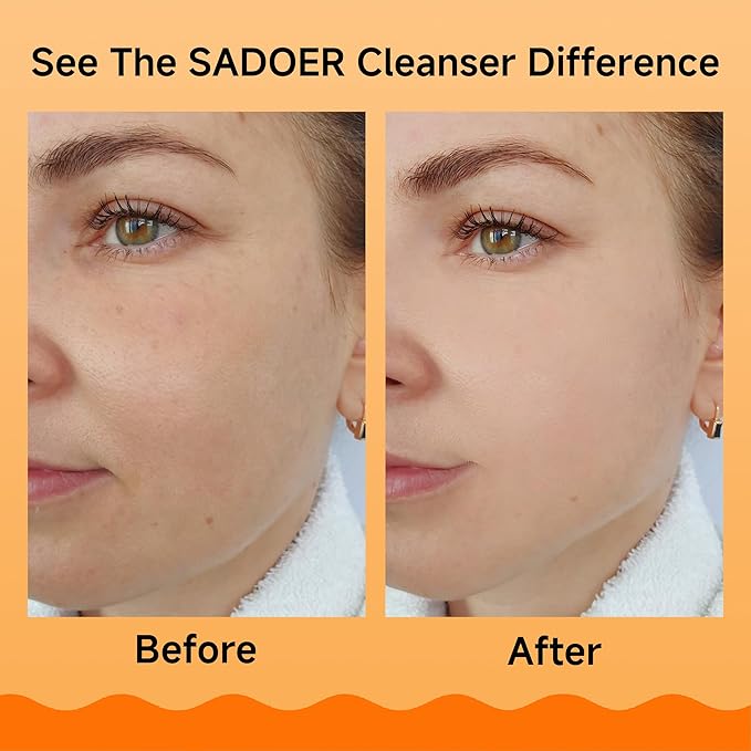 5X Vitamin C Face Cleanser 100g Niacinamide & Hyaluronic Acid, Gentle Pore Refining Daily Wash for Oily &Dull Skin,Clear,Oil Balancing, Popular Skincare Gift Women