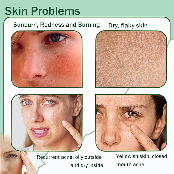 Moisturizing Gel for Face & Body,Non-sticky Gel After Sun Aloe Lotion Skin Care,Fast Absorbing Long Lasting Refreshing Hydrating Face Moisturizer for All Skin Types 08