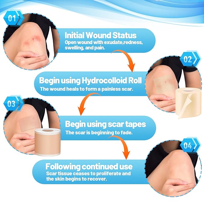 Arme Hydrocolloid Roll for Wound Care, Hydrocolloid Bandages(2in*16ft)&Scar Sheets(2in*16ft) First Aid Kit, Ultra Absorbent Medical Grade Hydrocolloid Tape with Self-Adhesive for Burn Acne Blister
