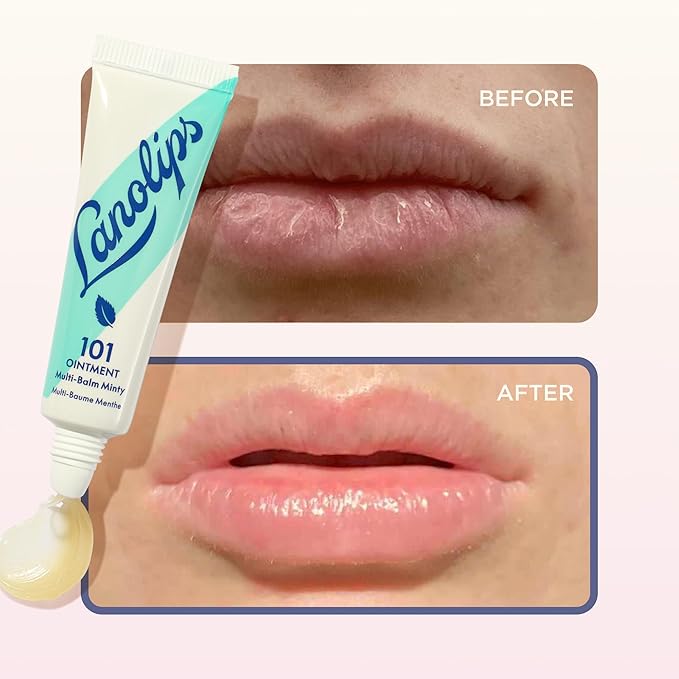Lanolips 101 Ointment - Lanolin Lip Balm for Smooth, Hydrated & Healthy Lips - Multipurpose Lip Ointment with Lanolin Oil for Dry Lips, Cuticles & More - Peppermint (0.52 oz)