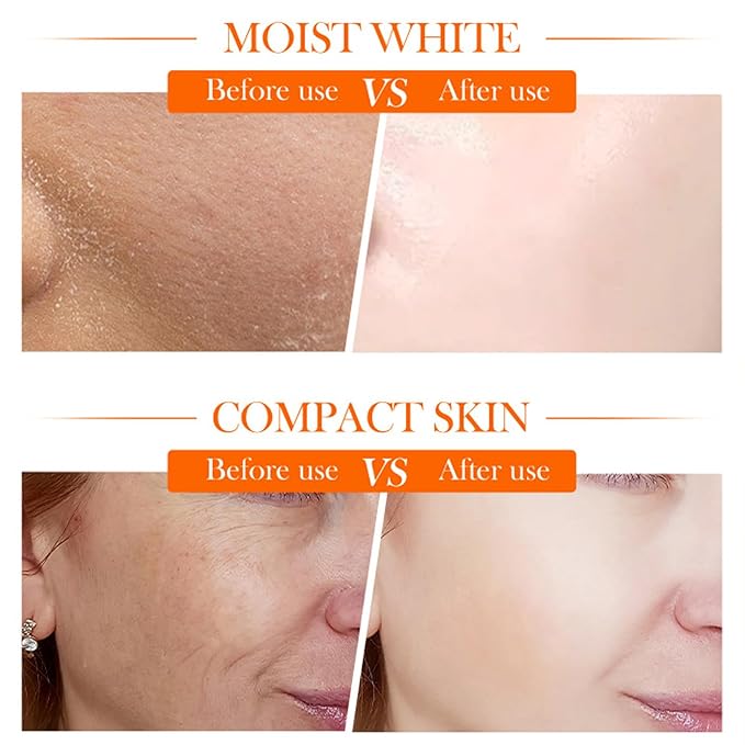 5X Vitamin C & Niacinamide Moisturizer with Hyaluronic Acid - Brightening & Glow Cream for Dark Spots, Hydrating Face Cream 50g, TikTok Favorite Gift for Women