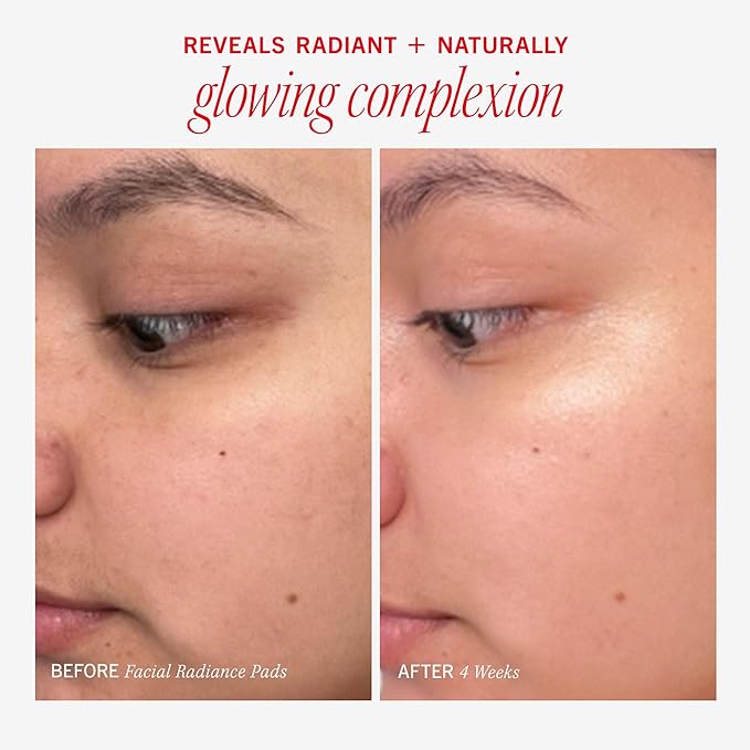 First Aid Beauty - Facial Radiance Pads with Glycolic & Lactic Acids, Daily Exfoliating Pads with AHA, Visibly Smaller Pores, Help Tone & Brighten Skin, One-Step Makeup Prep, Compostable, 90