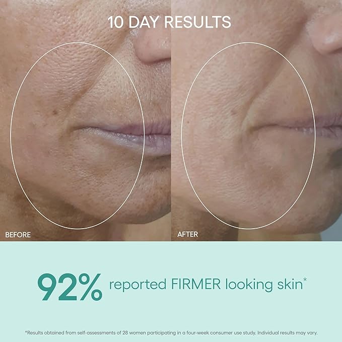 Algenist Algae Peptide Regenerative Face Moisturizer - Restorative Wrinkle Cream + Peptide Moisturizer for Instant Hydration + Skin Barrier Protection - Formulated with Patented Alguronic Acid (2 oz)