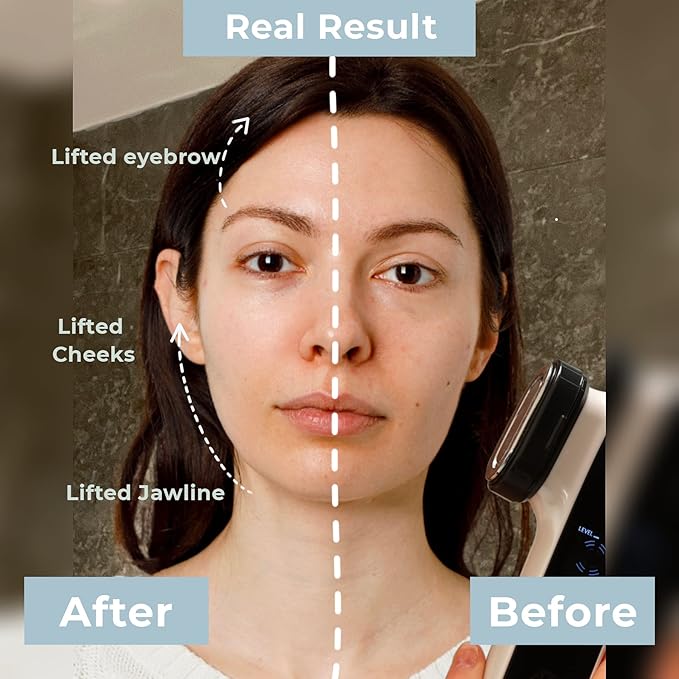 Radio Frequency Skin Tightening Machine, 6-in-1 Rechargeable Anti-Aging Skin Care Microcurrent Facial Device, Red Light, Wrinkle Remove, Rejuvenation, Skin-Firming, Coal Black and Pearl White