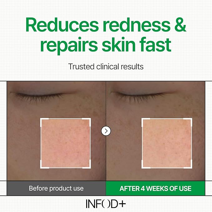 INFODPLUS Korean Skin Care Sensitive Face Cream, Lightweight Moisturizer with Ceramides & Panthenol, Skin Barrier Support & Deep Hydration, Low pH Daily Cream for AM/PM Use, 50ml