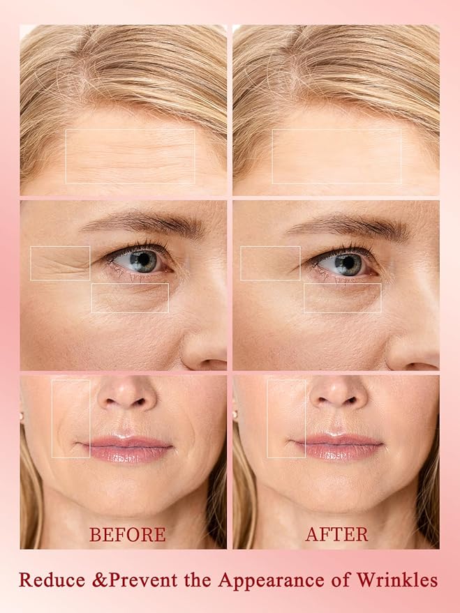 Radio Frequency Skin Tightening Device, Anti-Aging Face Machine for Wrinkle Removal, Lifting & Firming, Wireless Home Beauty Device with 3 Levels, at-Home Skin Renewal