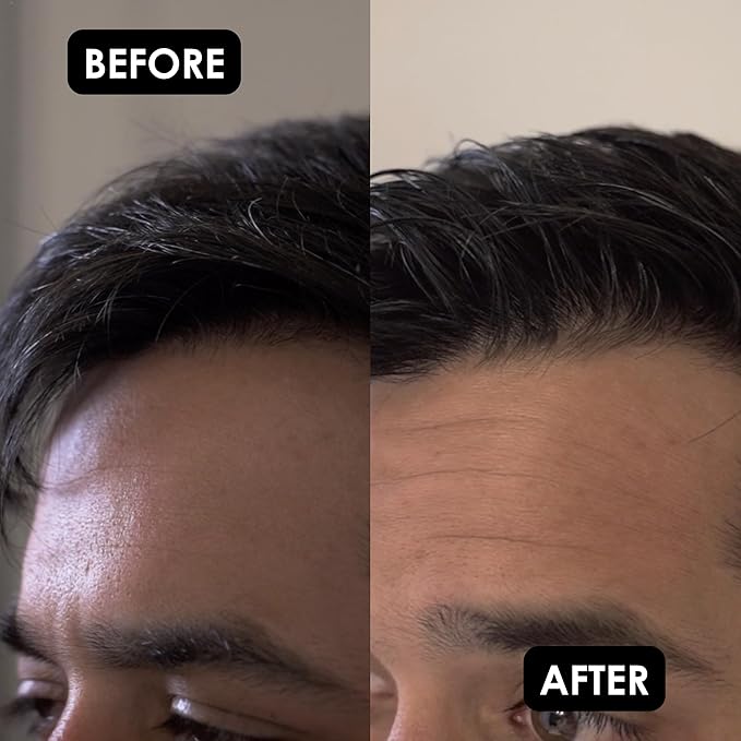 Rolda Black Hair Gel for Men - Medium Hold Styling Gel with Activated Charcoal for Wet Look - Covers Grays & Enhances Black Hair - Flake + Alcohol Free (8.81 oz)