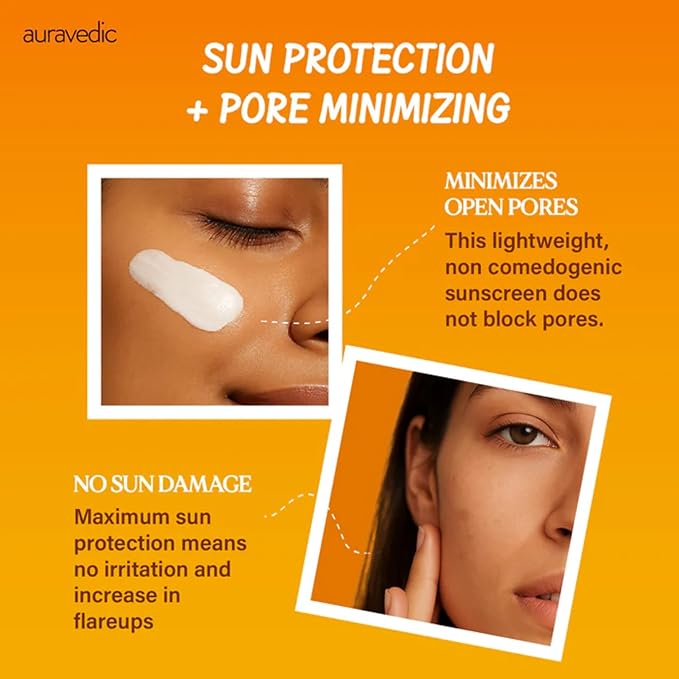 Auravedic Acne Calming Sunscreen SPF 50 PA++++ | Oil-Free Broad Spectrum UVA/UVB Face Sunscreen with 5% Niacinamide & 2% Salicylic Acid | For Oily & Acne-Prone Skin | 2.12 Oz (60g)