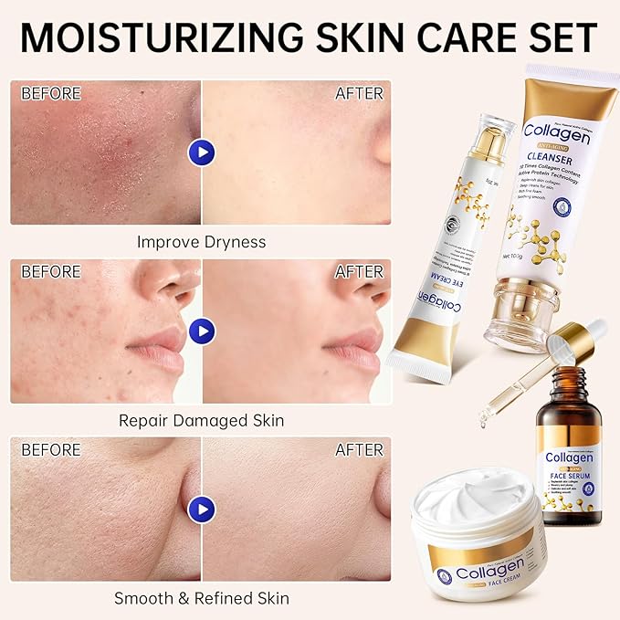 Collagen Skin Care Set, Anti Aging Skincare Set for Reduce Wrinkles, Shrink Pores, Smooth Fine Lines, Hydrating, 4 Pcs Travel Skincare Kits for Women with Cleanser, Serum, Cream, Eye Cream.