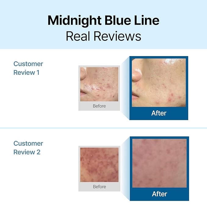 DearKlairs Midnight Blue Calming Cream | Face Moisturizer for Redness Relief, Guaiazulene, EGF & Ceramide, Post-Treatment Recovery, Korean Vegan Skincare for Sensitive Skin, 0.7 Oz (Pack of 1)