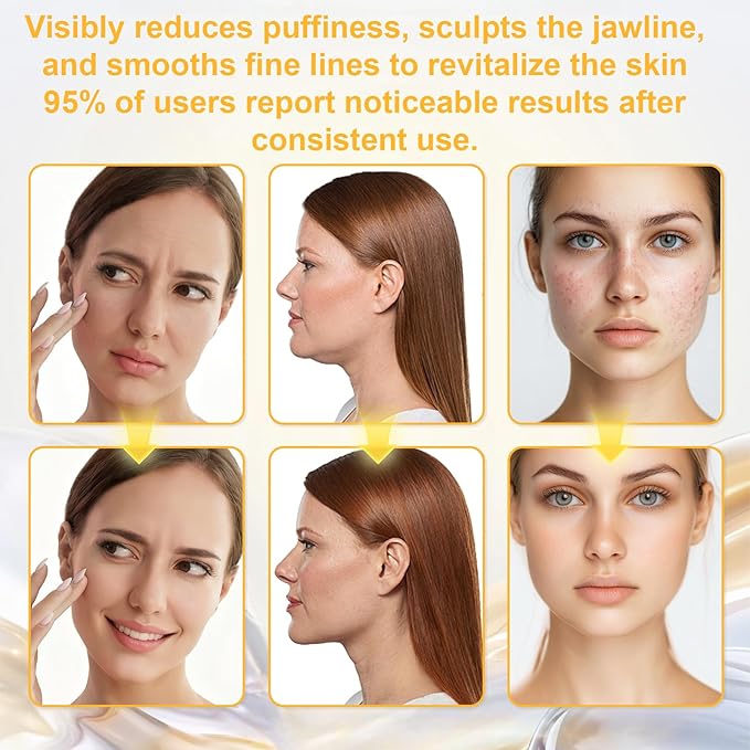 New Lymphatic Contour Face Brush, Lymphatic Drainage Massager, Double Chin Reducer, Gua Sha Facial Tools,9-Function Gear Adjustment, Facial and Body Sculpting,for Jawline & Puffiness (White)