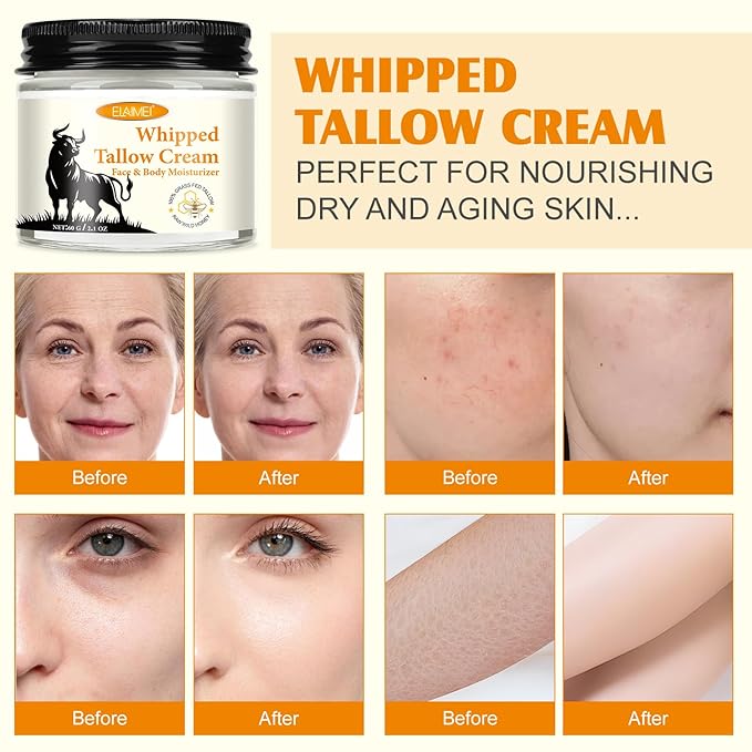 Acorn + Oak Grass Fed Beef Tallow For Skin - Face & Body,Organic Whipped Tallow Moisturizer for Women Girls 2.1oz (Unscented)