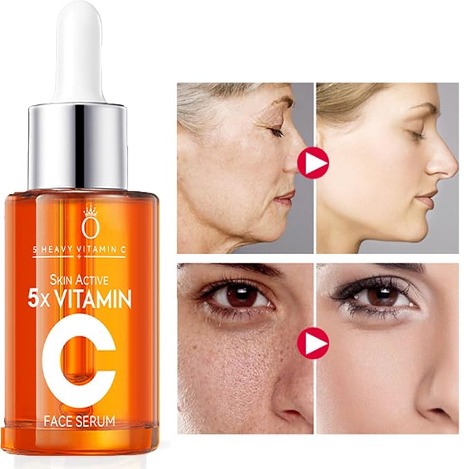 5X Vitamin C 20% Serum for Face with Hyaluronic & Amino Acids - Boost Skin Collagen, Hydrate & Plump Skin, Anti Aging & Wrinkle Facial Serum, All Skin Types, 30 ML / 1.0 Fl Oz (Vitamin C Serum)