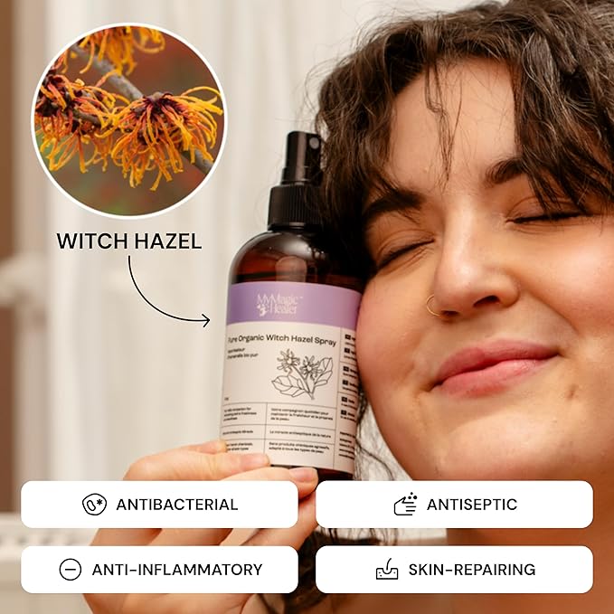 MyMagicHealer Organic Witch Hazel Spray | Calming Flare Care | Gentle Relief for Inflamed, Irritated, Swollen Skin | Ideal for Cystic Acne, Boils, Hidradenitis, Cysts, Ingrowns, and Fissures (8 oz)