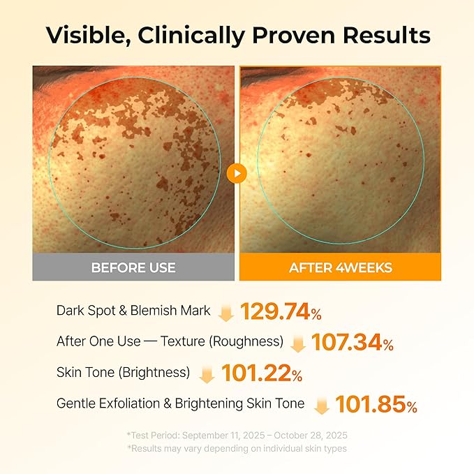 Dr.Melaxin TX Kojic Acid Turmeric Toner Pads, 70 Sheets, Tranexamic Acid, Termeric, Beautiful Skin, Brightening Toner Pad, Pigmentation, Keratin, Korean Skin Care, Korean Cosmetics