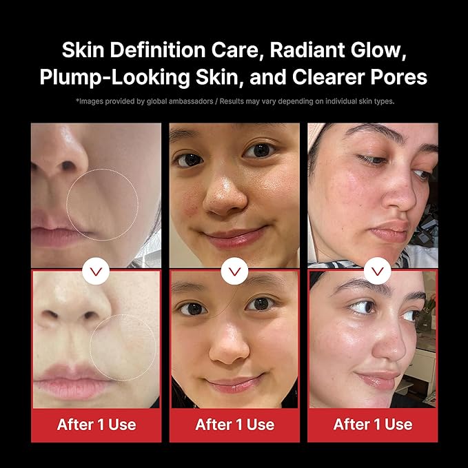 medicube Hydration & Calm Facial Device Set: Booster Pro Black and Hyaluronic Acid Capsule Cream | for Radiant and Firmer-Looking Glow and Soothing Care, Korean Skincare