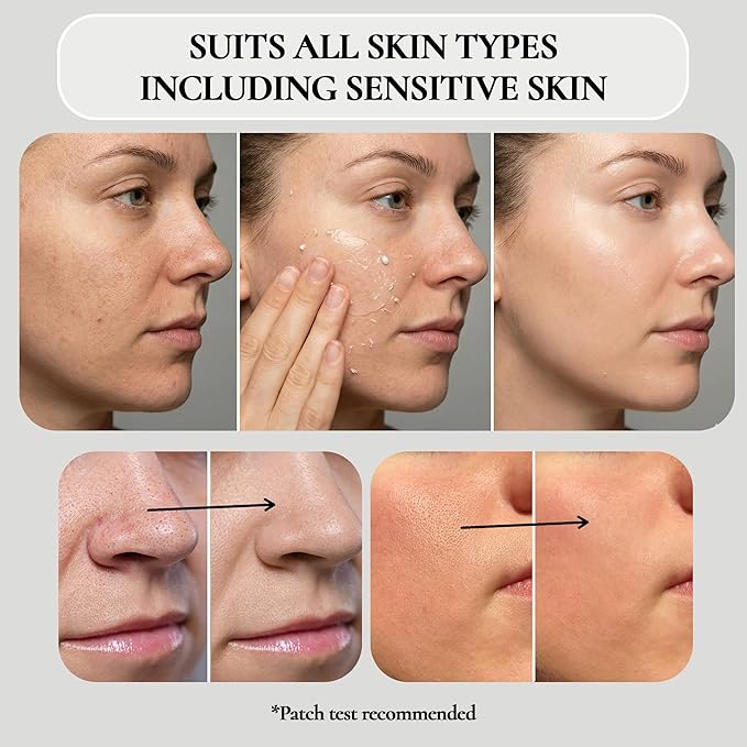 Vivo Per Lei Facial Peeling Gel - Helps Address Dead Skin Buildup - Gentle Exfoliating Gel for Rough, Dry, Sensitive or Mature Skin - Face and Body Scrub - Non Abrasive - 4.05 Fl. Oz. - Pack of 4