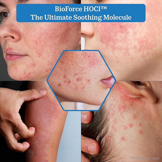 BioForce HOCl Pure Hypochlorous Acid Spray Refill for Face & Body (16.9 Oz) - Acne-Prone Skin & Eczema, Piercing aftercare, Made in Canada, Gentle Skin Cleanser & Toner, pH Balanced, Non-comedogenic