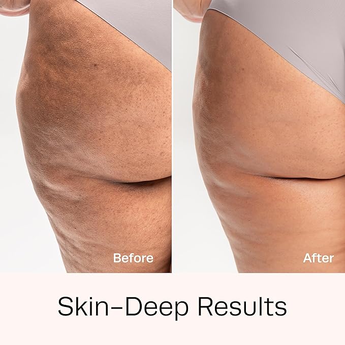 Hot Vita Retinol Body Toner - Nighttime Anti-Aging & Anti-Cellulite Formula to Tighten Skin, Smooth Complexion, & Enhance Radiance - Body Serum for Women - Made with Natural, Skin-Safe Ingredients