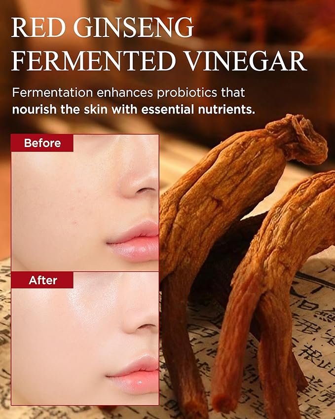 Bonyongo Red Ginseng Vinegar Toner – Rich Essence Toner for Dry & Mature Skin | 6-Year Fermented Ginseng for Anti-Aging & pH Balance | Korean Hanbang Skincare, 5.07 fl oz