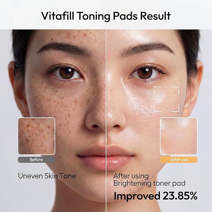 Licorne Vitafill Toning Pads (70 Count) - Idebenone & Vitamin C Glow Boosting Toner Pads for Dullness & Uneven Skin Tone - Korean Exfoliating Face Pads with Niacinamide for Daily Radiance