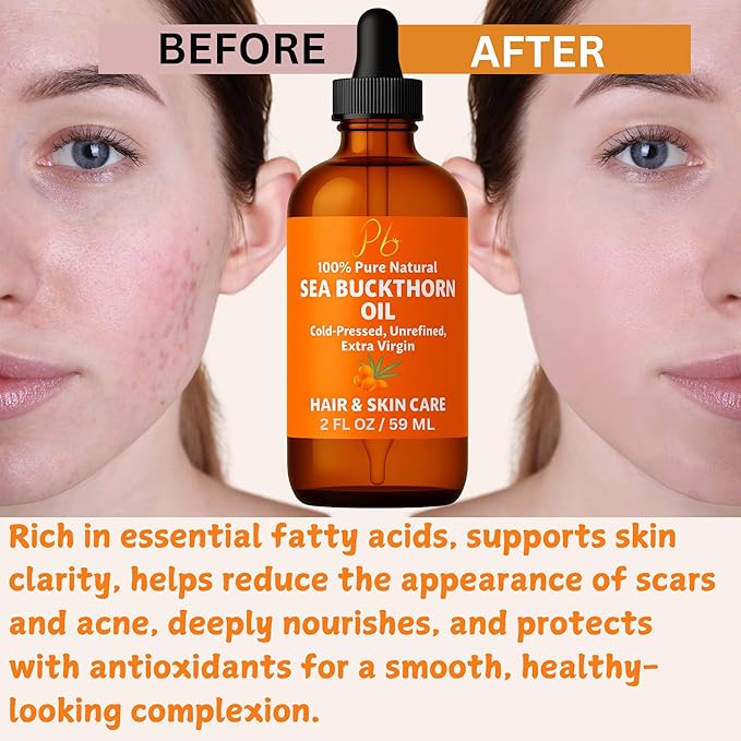 Sea Buckthorn Oil – 100% Pure Cold-Pressed from Fruit & Seed – Sea Buckthorn Seed Oil for Face, Hair, Skin & Nails – Supports Radiant, Youthful-Looking Skin – Amber Glass Bottle 2 fl oz