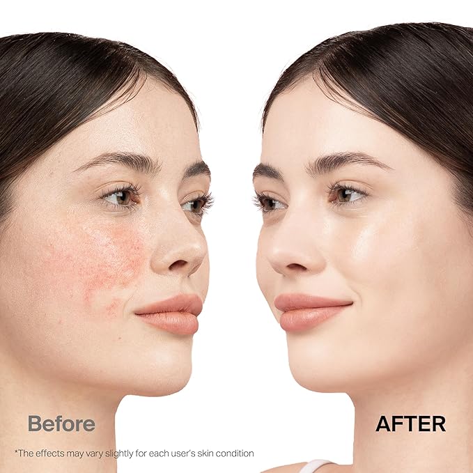 Meebak Cica Redness Color Correcting SPF 50 - Green to Beige CC Cream with Niacinamide and Centella - Neutralizes Redness for Fair-to-Medium Skin Tones - Korean Skincare