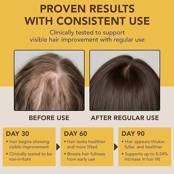 Botanic Hearth Batana Oil for Hair Growth & Hair Treatment Oils 2 Fl Oz | Dr Sebi Inspired, 100% Raw & Pure Batana Oil | Scalp & Hair Treatment for Thickness & Strength | All Hair Types