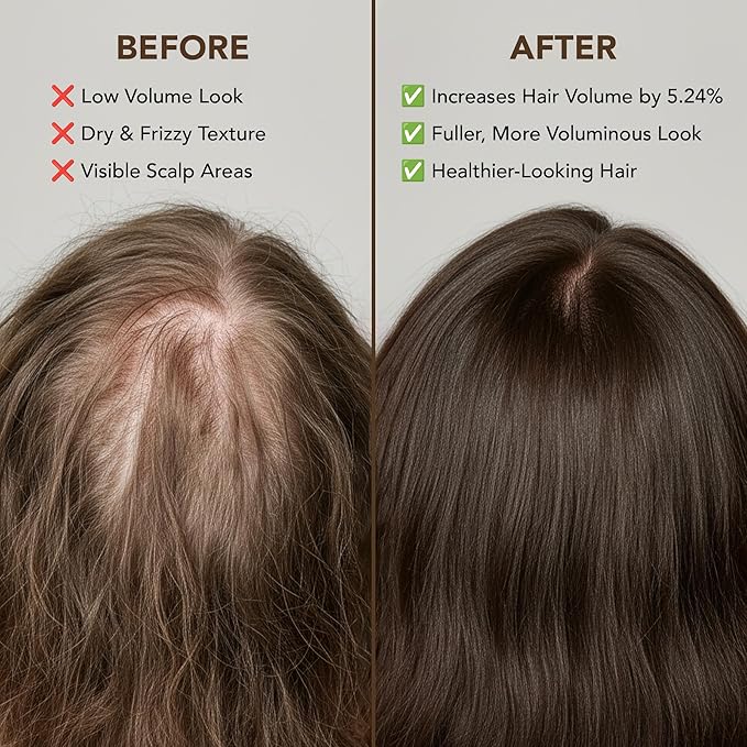Botanic Hearth Batana Oil for Hair Growth & Hair Treatment Oils 2 Fl Oz | Dr Sebi Inspired, 100% Raw & Pure Batana Oil | Scalp & Hair Treatment for Thickness & Strength | All Hair Types