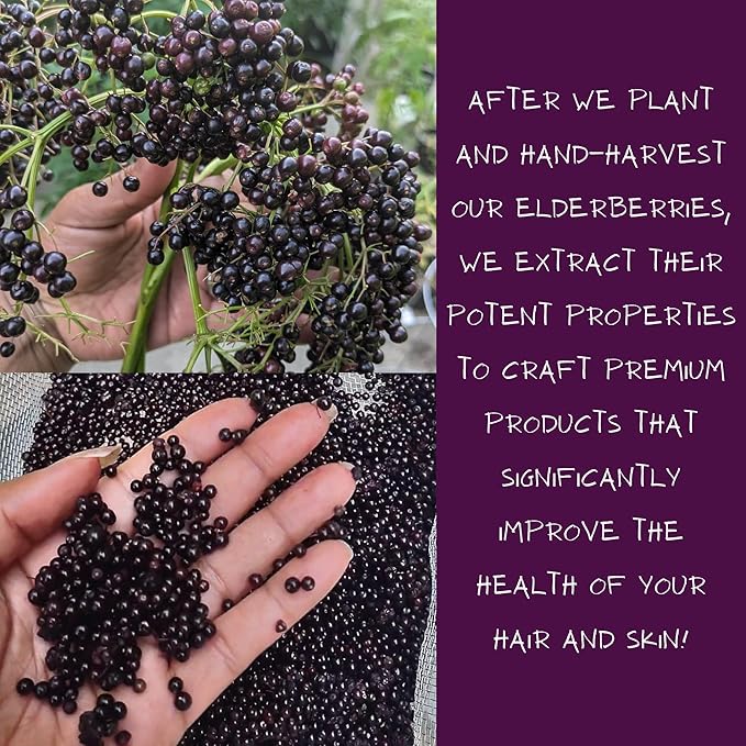 Elderberry Soothing Facial Toner for Oily & Combination Skin | Tightens Pores, Clears Pimples, Reduces Breakouts, Rejuvenates Dull Skin | Witch Hazel, Aloe Vera & Rose Water | 8 fl oz
