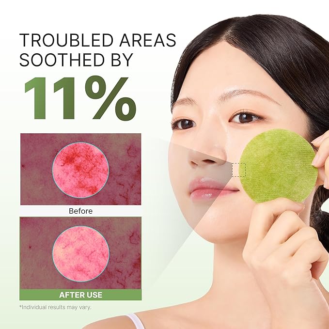 P.CALM Azelaic Acid Matcha 1000 Calming Gauze Gel Toner Pad – Azelaic Acid & Matcha for Gentle Exfoliation and Skin Soothing, Sensitive Skin Care, Korean Skincare (110g / 3.71 fl.oz., 60 Pads)