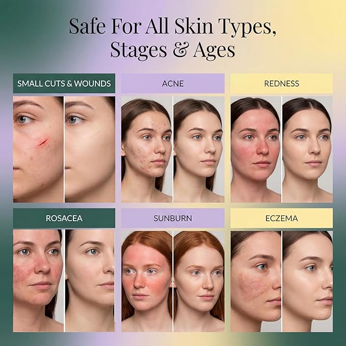 Jusspray™ Hypochlorous Acid Spray for Face and Skin | HOCI Facial Cleanser Mist | 32oz Refill Hypochlorous Acid for Face, Skin, Acne, Eczema, Body Acne Sprays, Piercing Aftercare, Wound Solution