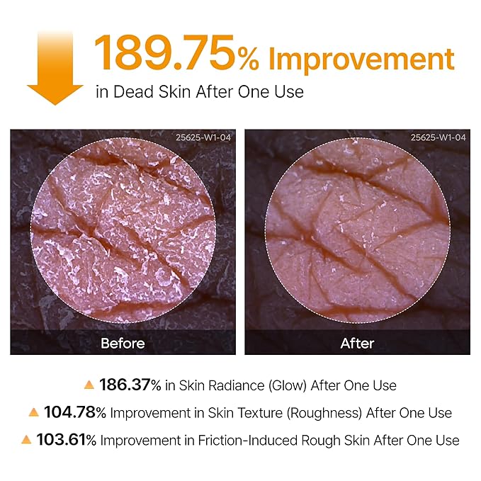 Dr.Melaxin Body Keratin Care Kojic Acid Turmeric Spray Gently Exfoliating Peeling Solution Korean Skincare All Skin Types 200ml