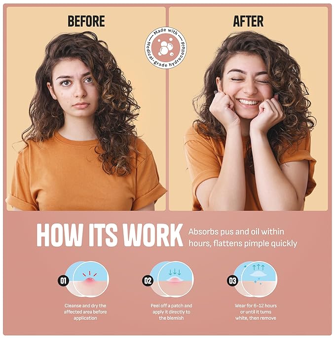 Pimple Patches for Face – Day & Night Acne Patches for Fast Healing, Skin Clarity – Invisible Hydrocolloid Patches, Waterproof Spot Treatment – All Skin Types Zit Patches of 60/120/180