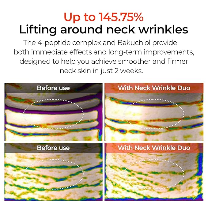 Dr. Melaxin Neck Care Cream Set, Volume Lifting Treatment, Necklinephalt and Necksphalt Formula korean skin care