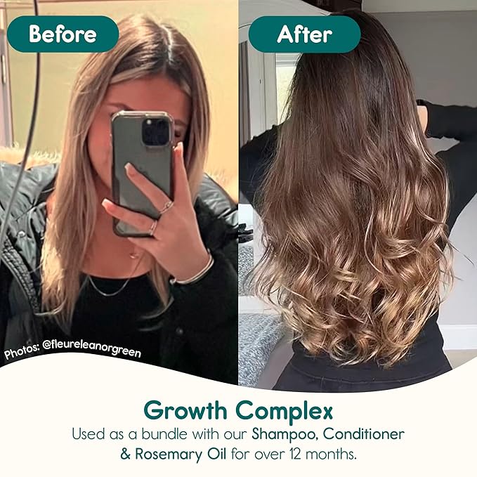 Nature Spell Hair Growth Complex Conditioner, Sulfate & Paraben Free, Nourishing & Strengthening, Infused with Hyaluronic Acid & Vitamin B5, For All Hair Types, Vegan, 10.14 fl oz