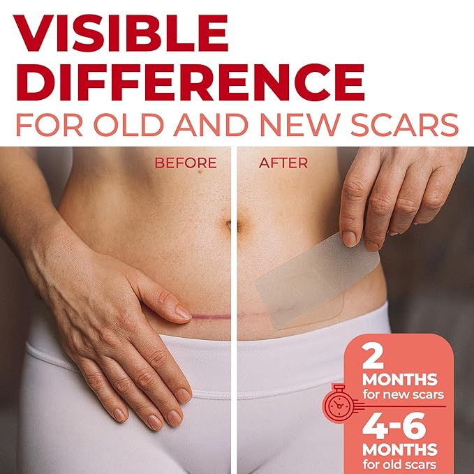 Medical Grade Silicone Scar Sheets - Transparent - 6pk (7”x1.6”) - Visible Difference on C-Section Scars - Reusable Silicone Sheets for Scars - Easy to Use C Section Scar Silicone Strips