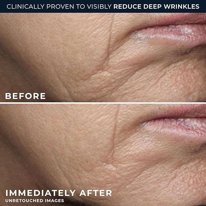 RoC Deep Wrinkle Rich Cream, Fragrance Free, Daily Anti-Aging Firming Cream For Persistent Dryness & Younger-Looking Skin For Women & Men, With Line Smoothing Eye Cream Packette, 1.7oz