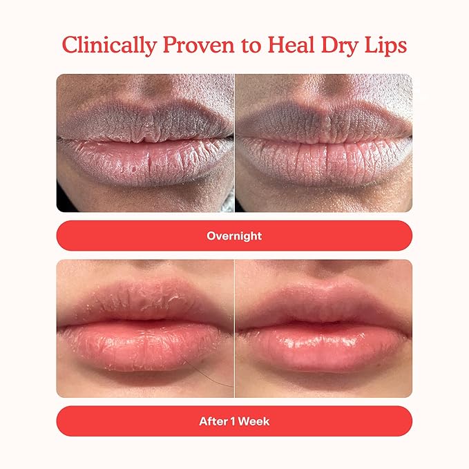 Tower 28 LipSoftie Tinted Lip Balm Treatment - Hydrating Glossy Balm + Overnight Lip Mask with Jojoba Oil + Shea Butter - Sweet, Cushiony Formula for Smooth, Soft Lips - Red Bean Mochi (0.38 oz)