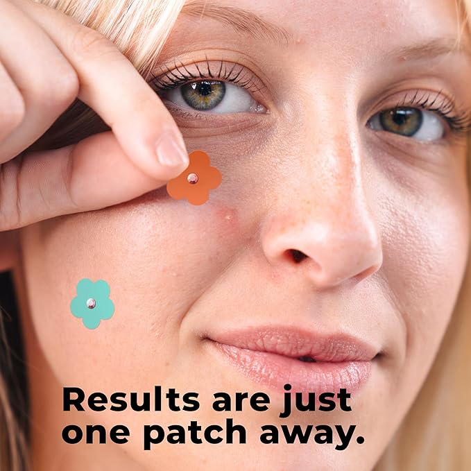 Acne Patches Flower Beads Design (80 pack, 5 colors) Zit Patches Star Sticker