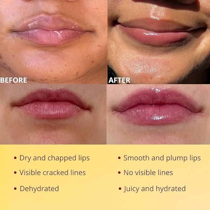 Original My Bee Balm Lip Balm – Hydrating Lip Care with Watermelon, Strawberry & Honey Pot – Moisturizing Balm for Dry, Chapped & Cracked Lips with Propolis, Honey & Vitamin E