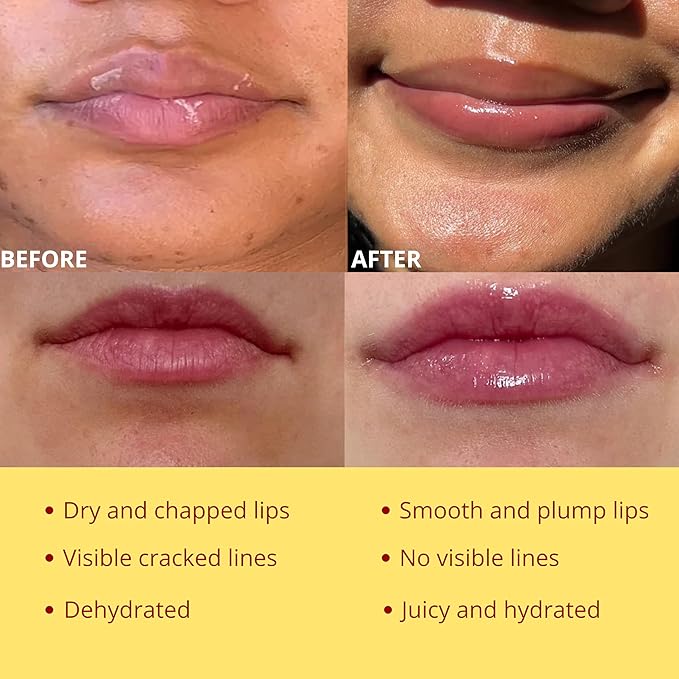 Original My Bee Balm Lip Balm – Propolis Hydrating Balm – Honey Pot for Dry, Chapped & Cracked Lips – Deeply Moisturizes & Hydrates Lips with Organic Beeswax & Vitamin E