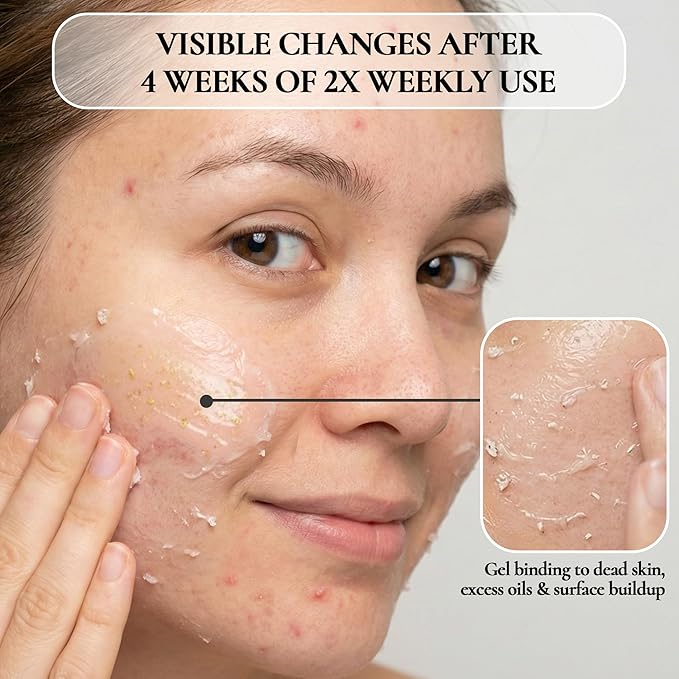 Vivo Per Lei Facial Peeling Gel - Helps Address Dead Skin Buildup - Gentle Exfoliating Gel for Rough, Dry, Sensitive or Mature Skin - Face and Body Scrub - Non Abrasive - 4.05 Fl. Oz. - Pack of 3
