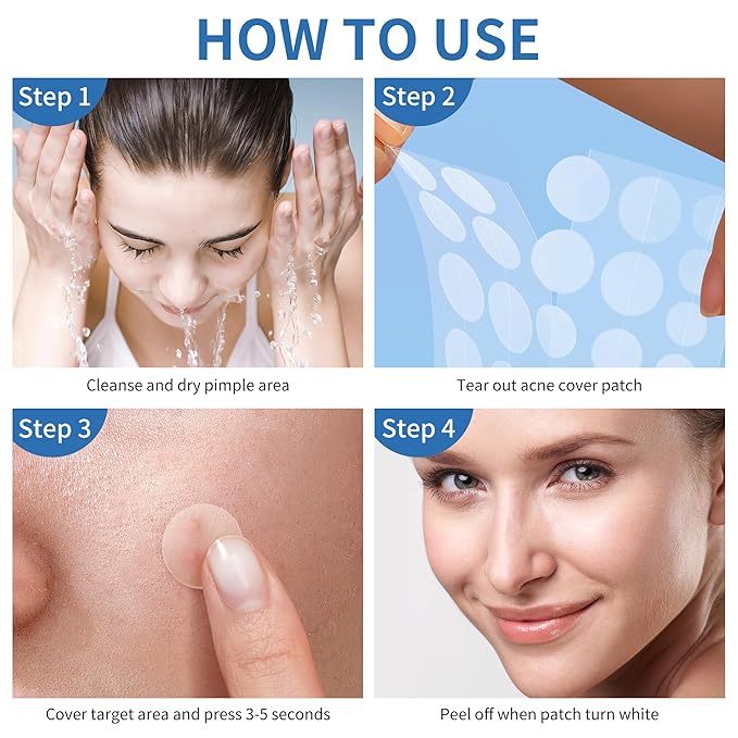 Pimple Patches for Face - 3 Size 510 Counts Hydrocolloid Acne Patches for Covering Zits and Blemishes, Spot Stickers with Salicylic Acid, Tea Tree Oil & Calendula Oil(8mm,10mm,12mm)