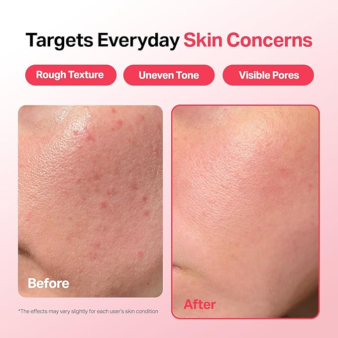 Meebak Camellia Clear Daily Exfoliating Serum – 2% Niacinamide + AHA & PHA, Gentle Chemical Exfoliant Face Serum for Skin Texture & Tone, Hydrating Pore Minimizer for Face, Korean Skincare