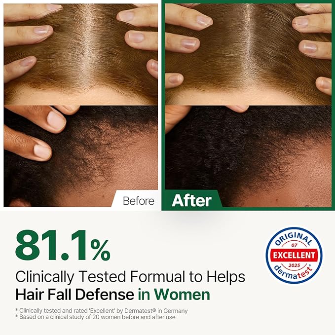 Alpha Erguen Women’s Hair Loss Care Treatment, Vegan Formula for Dual Scalp & Hair Cortex Repair, Strengthens, Restores & Nourishes Damaged Hair, 500ml / 16.9 fl oz