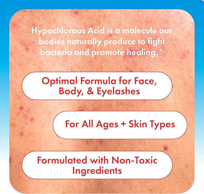 Hypochlorous Acid Spray for Face, Skin & Eyelids – pH-Balanced HOCl Facial Spray Safe for Acne, Red & Sensitive Skin – Gentle Non-Toxic Toner & Cleanser Mist for Clear, Hydrated Skin, 8 oz