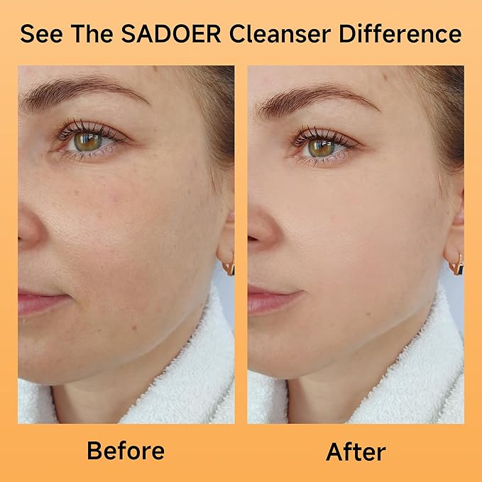 5X Vitamin C Face Cleanser 100g(2 Bottle),SADOER Facial cleanser Niacinamide & Hyaluronic Acid, Gentle Pore Refining Daily Wash for Oily &Dull Skin,Clear,Oil Balancing,TIKTOK Popular Skincare Gift